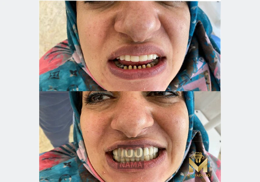 دندنسازی و دندانپزشکی درمانی و زیبایی