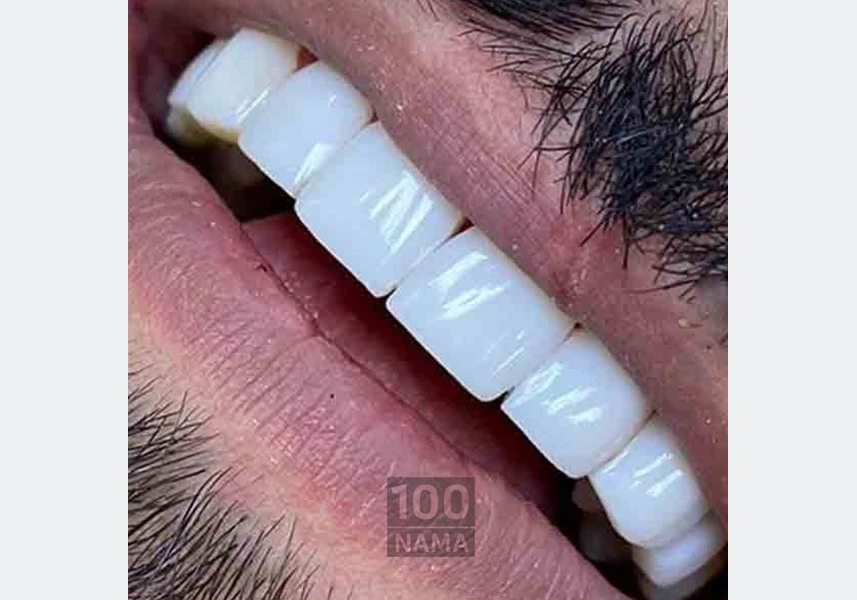 دندنسازی و دندانپزشکی درمانی و زیبایی