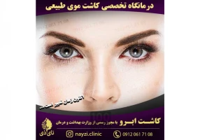 کاشت موی طبیعی