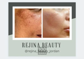 فیشیال تخصصی درمانی درماکوئین