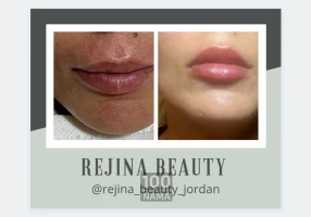 فیشیال تخصصی درمانی درماکوئین