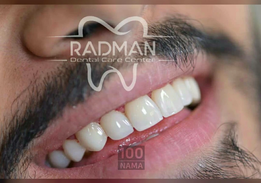 دندانپزشکی زیبایی کرج گلشهر