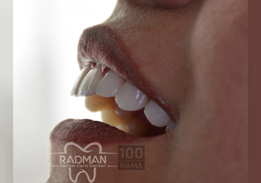 دندانپزشکی زیبایی کرج گلشهر