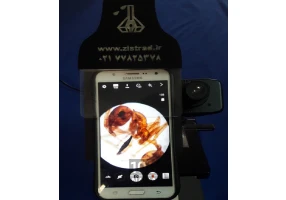 عکسبرداری میکروسکوپی موبایل
