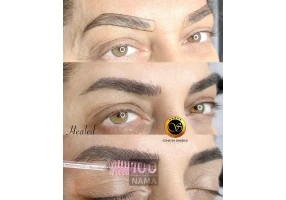 فیبروز و میکروبلیدینگ شهسوار سمیه شهبازی