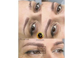 فیبروز و میکروبلیدینگ شهسوار سمیه شهبازی