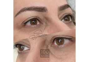 فیبروز و میکروبلیدینگ شهسوار سمیه شهبازی