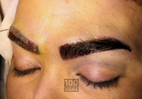 کاشت مو و ابرو و مژه به صورت تخصصی