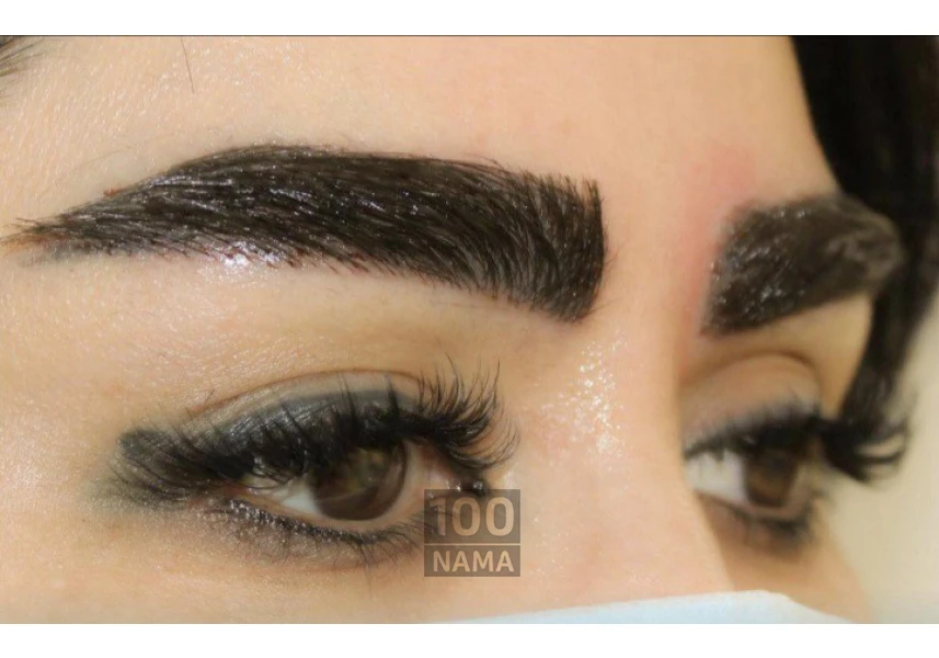 کاشت مو و ابرو و مژه به صورت تخصصی