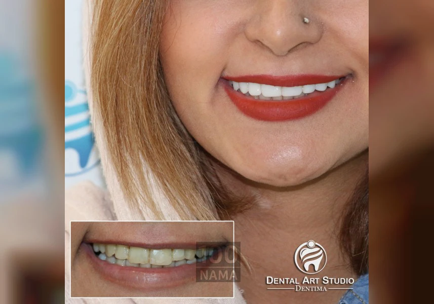 دندانپزشکی زیبایی ، ایمپلنت و طراحی لبخند دکتر سپهریان