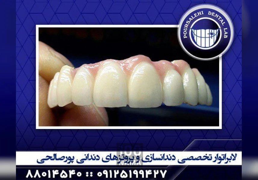 دندانسازی در تهران aspect-image
