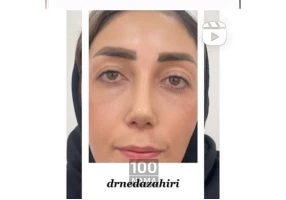 جراحی زیبایی در جردن