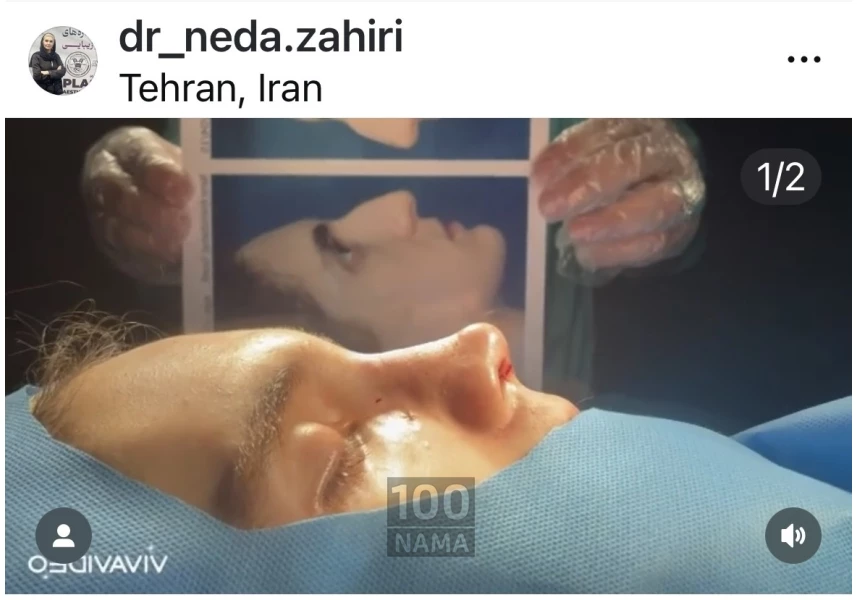 جراحی زیبایی در جردن