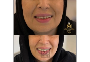 دندانسازی و دندانپزشکی رویال تهرانپارس