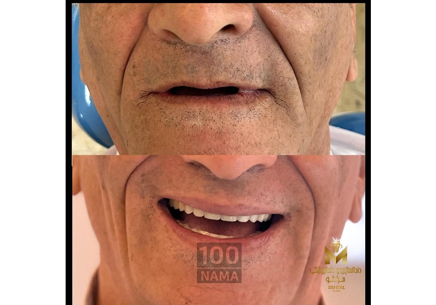 دندانسازی و دندانپزشکی رویال تهرانپارس