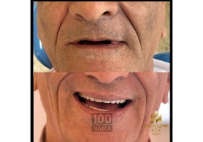 دندانسازی و دندانپزشکی رویال تهرانپارس