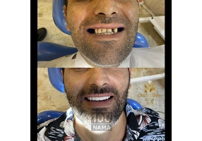 دندانسازی و دندانپزشکی رویال تهرانپارس