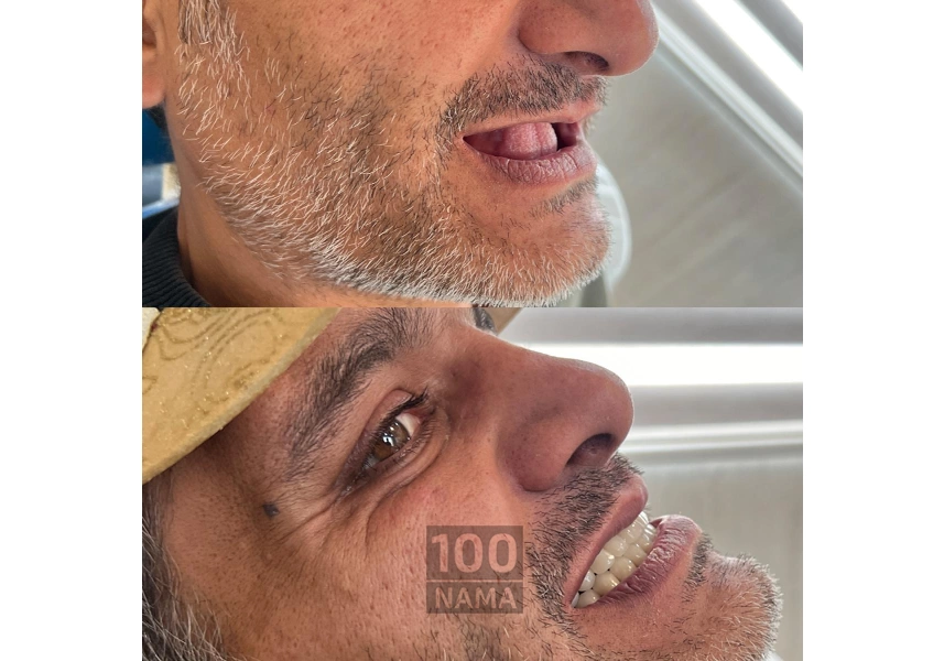 دندانسازی و دندانپزشکی رویال تهرانپارس