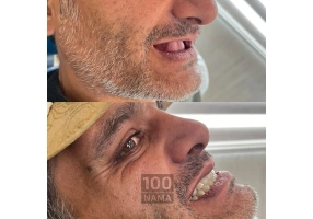 دندانسازی و دندانپزشکی رویال تهرانپارس