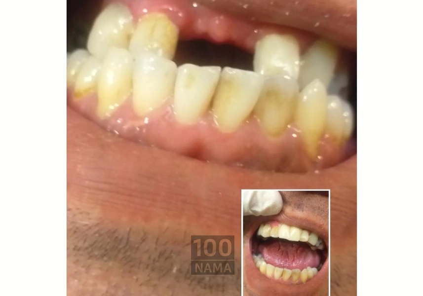 لابراتوار دندانسازی دندان مصنوعی سعادت آباد
