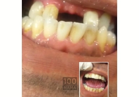 لابراتوار دندانسازی دندان مصنوعی سعادت آباد