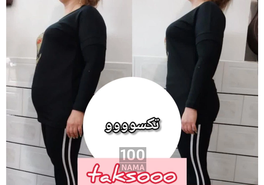 عرضه محصولات درمان چاقی 