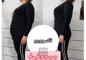 عرضه محصولات درمان چاقی 