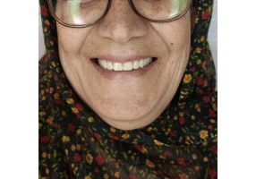 کلینیک دندانسازی و دندانپزشکی روشنا