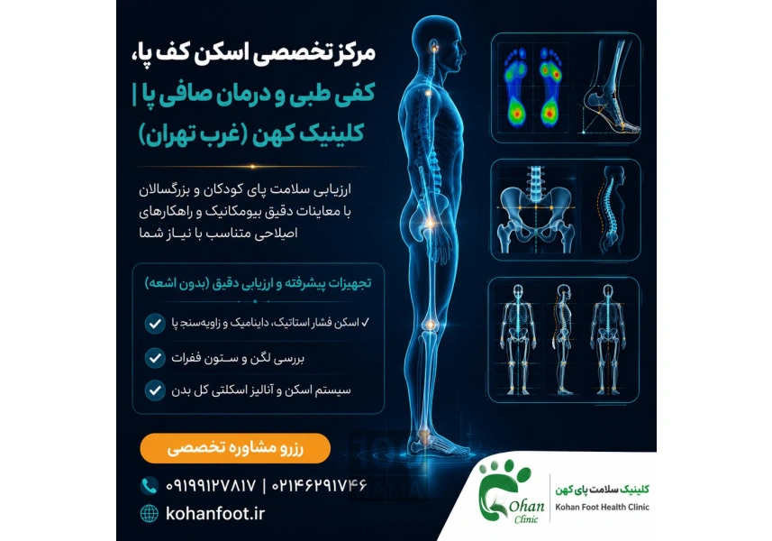 اسکن سه‌بعدی و کفی طبی هوشمند نزدیک گیشا